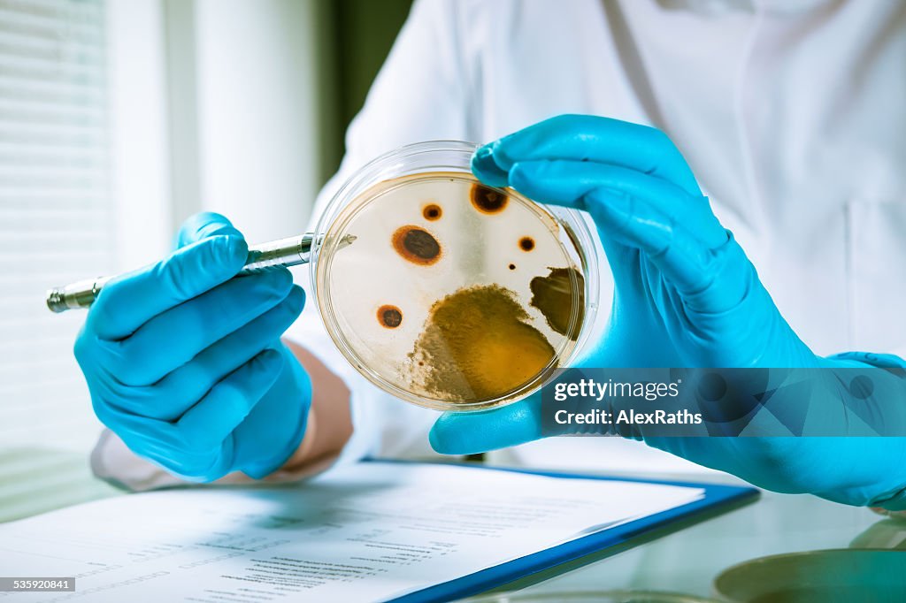 Agar plate with growing germs