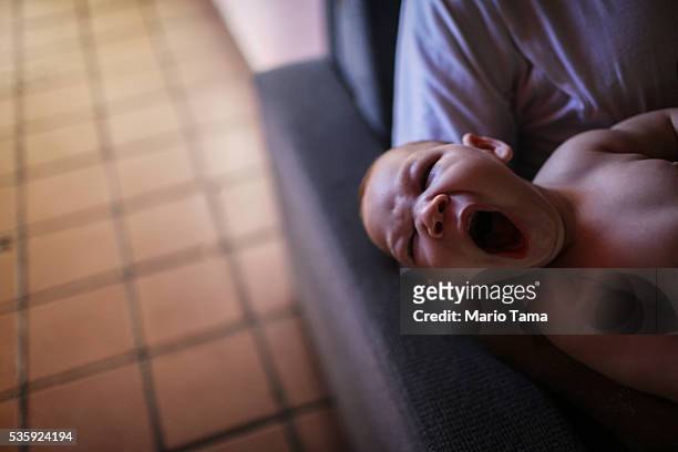 David Henrique Ferreira, 9-months-old, who was born with microcephaly, yawns at home on May 29, 2016 in Recife, Brazil. Microcephaly is a birth...