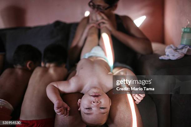 David Henrique Ferreira, 9-months-old, who was born with microcephaly, is stretched by his mother Mylene as his brothers huddle nearby on May 29,...