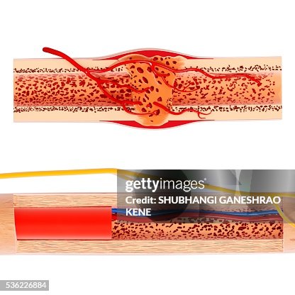 Human bone structure, computer artwork. Human bone structure, computer artwork.