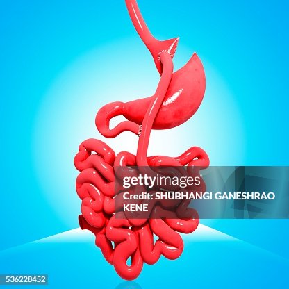 Gastric bypass, computer artwork. Gastric bypass, computer artwork.