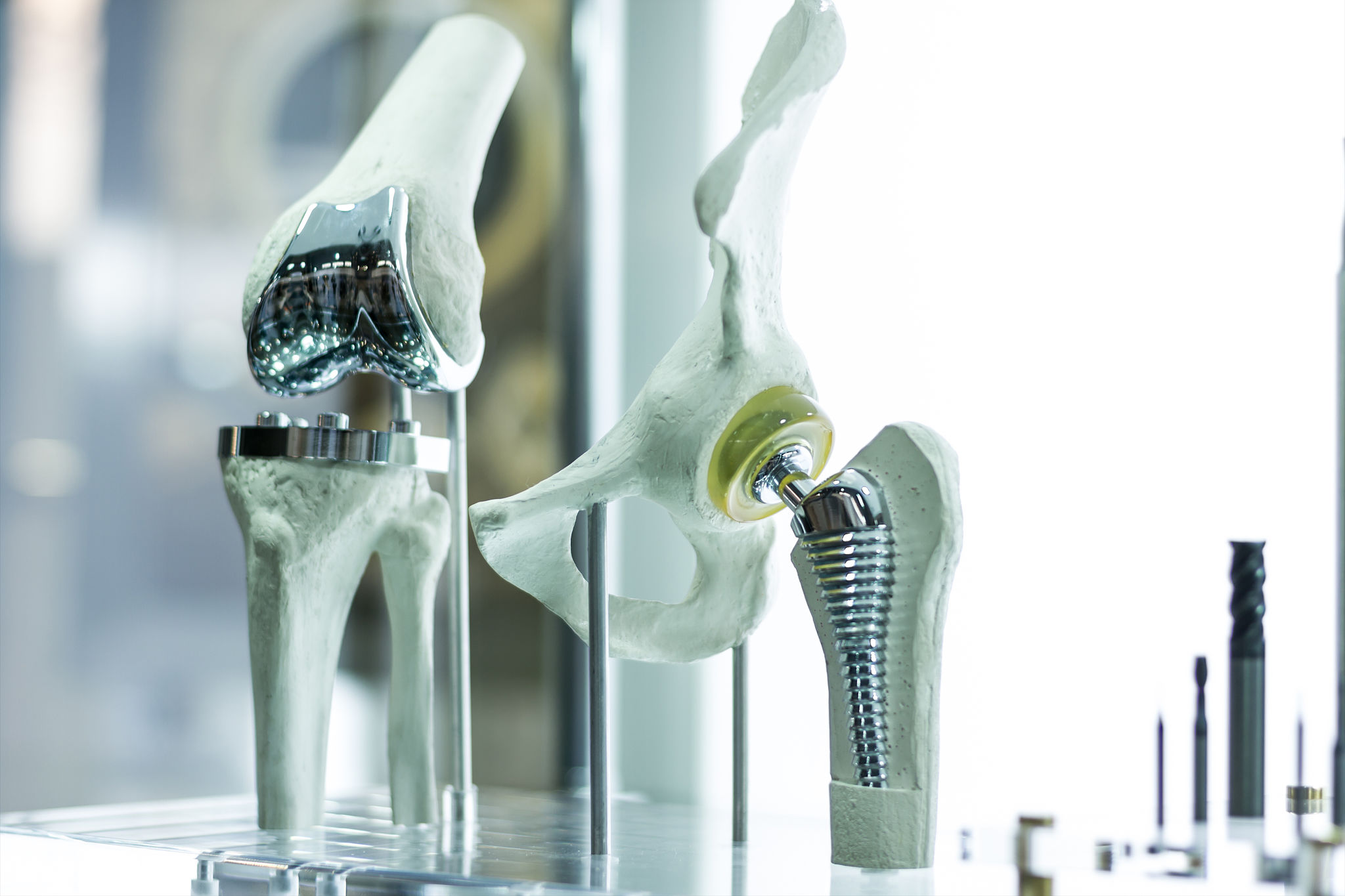 metal implant
