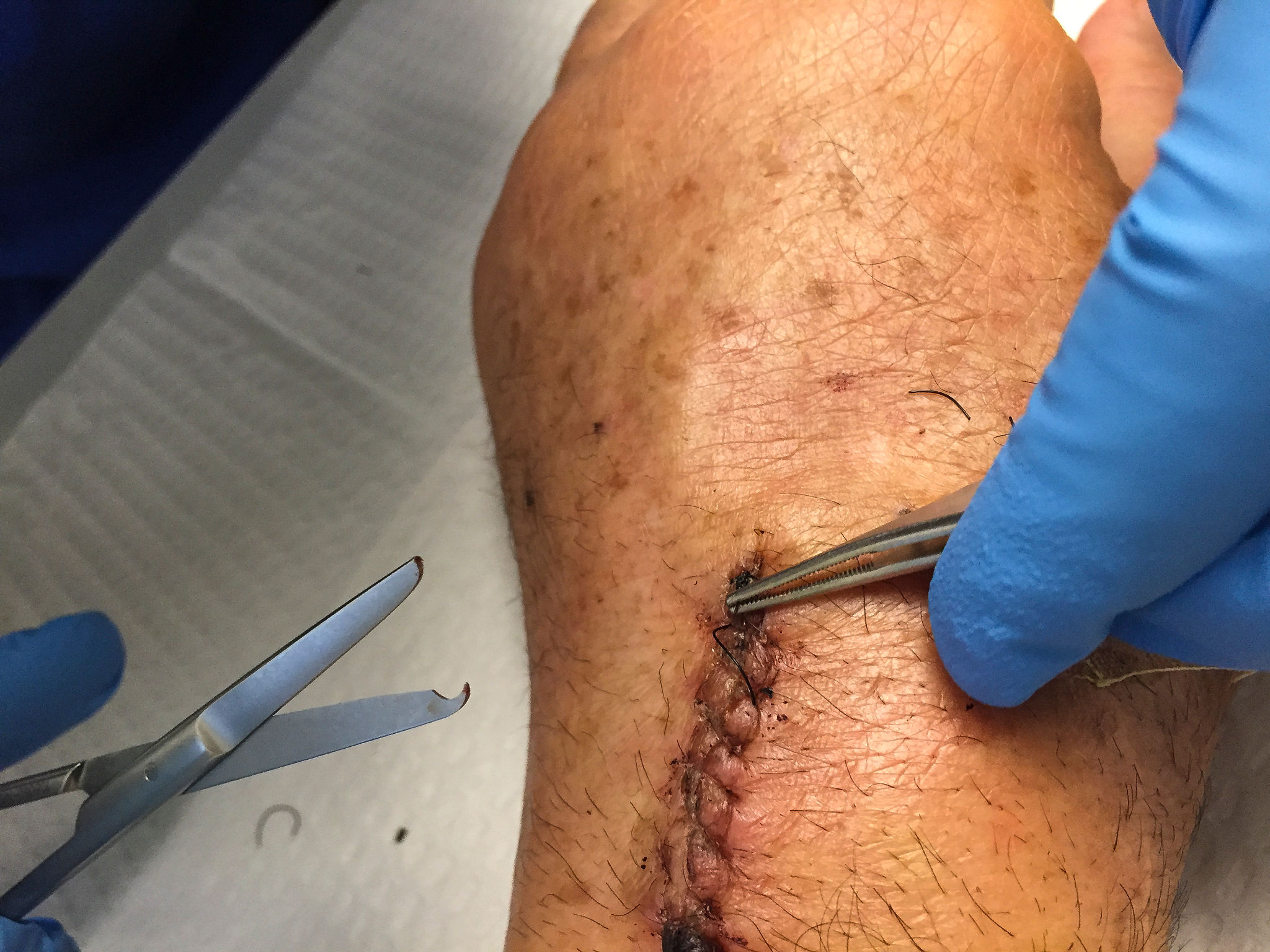 manutenzione pavimentazione