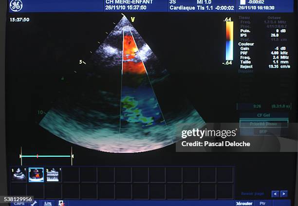 Echography Graphics 187 Echography Stock Photos, High-Res Pictures, and Images - Getty Images