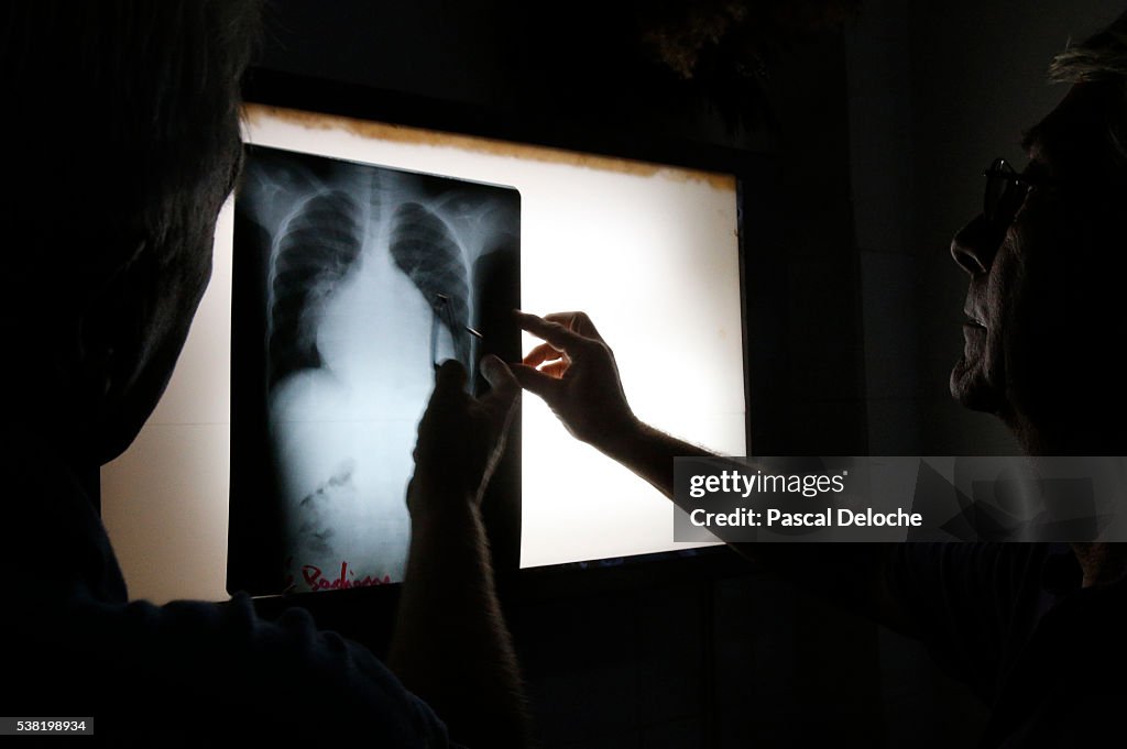 Human Thoracci Radiograph Thoracic Radiography High-Res Stock Photo - Getty Images