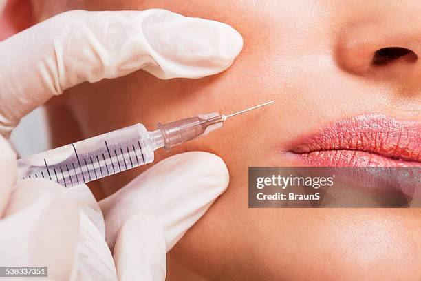 tratamiento de belleza con de botox. - boca humana fotografías e imágenes de stock