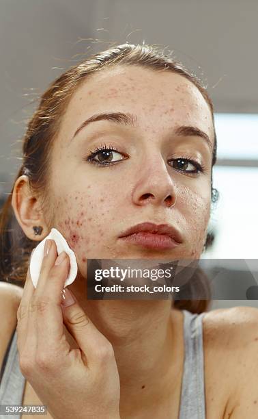 cleaning face - acne stock pictures, royalty-free photos & images