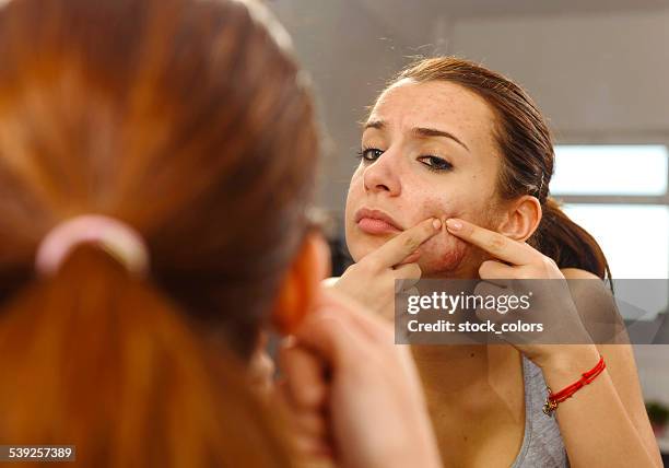 big skin problems - pimple stock pictures, royalty-free photos & images