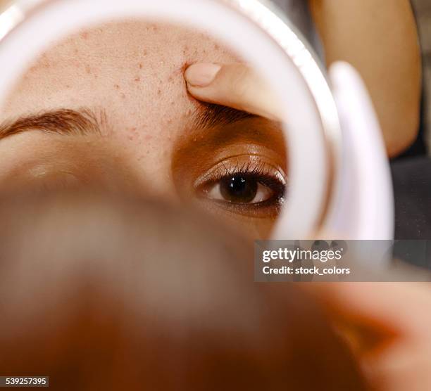 problematic skin - girl in mirror stockfoto's en -beelden