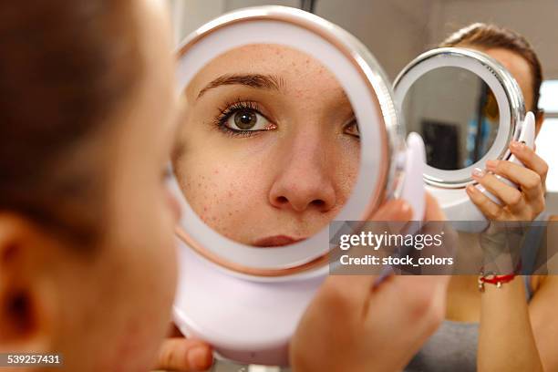 piel humana con acné - acné fotografías e imágenes de stock