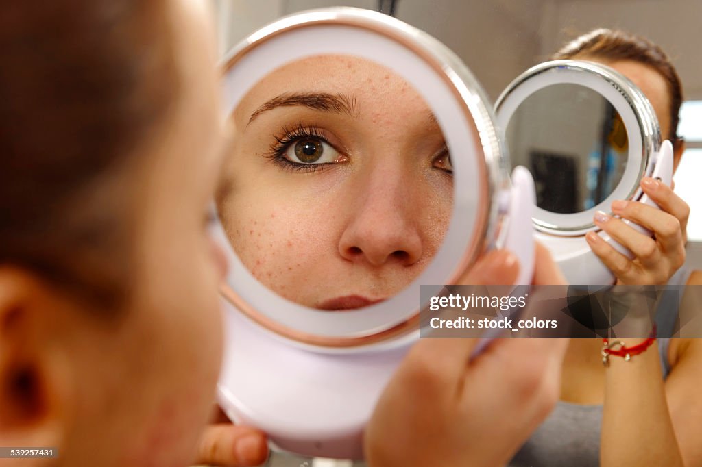 Pele Humana com acne