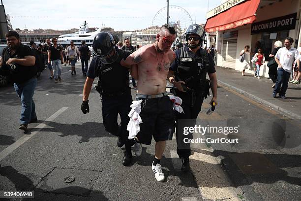 An injured England fan is arrested after clashes ahead of the game against Russia later today on June 11, 2016 in Marseille, France. Football fans...