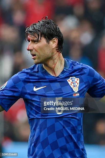Croatia's defender Vedran Corluka is pictured with blood dripping from a head injury during the Euro 2016 group D football match between Turkey and...