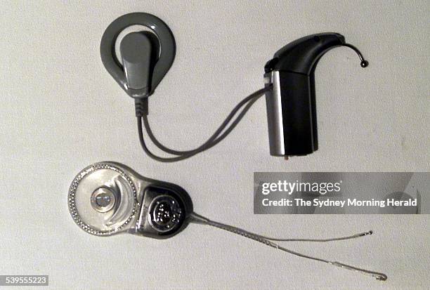 Cochlear Implant, Esprit 3G and Nucleus 24 Contour tm, 22 October 2005. SMH Picture by BRENDAN ESPOSITO