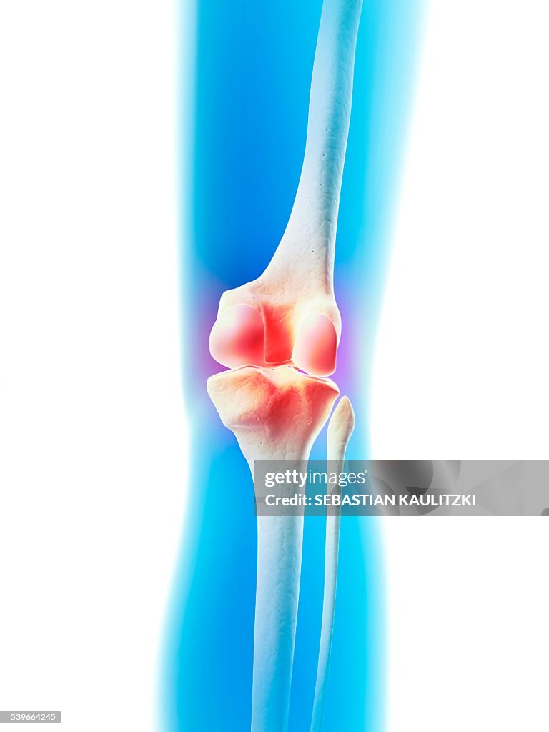 Human knee joint, illustration