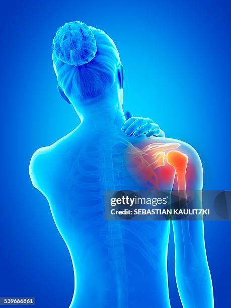 illustrazioni stock, clip art, cartoni animati e icone di tendenza di human shoulder pain, illustration - dolore fisico