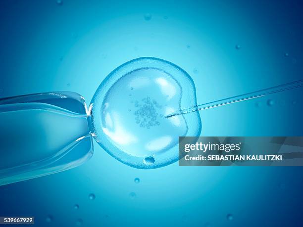 stockillustraties, clipart, cartoons en iconen met in vitro fertilisation, illustration - medische procedure