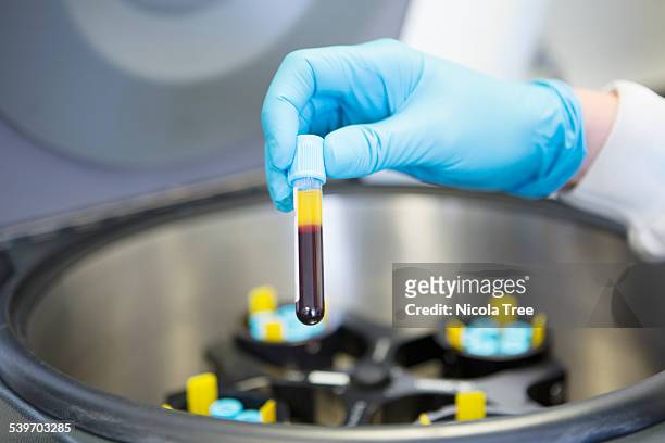 centrifugation of blood to produce platelet plasma - bloedplaatje stockfoto's en -beelden