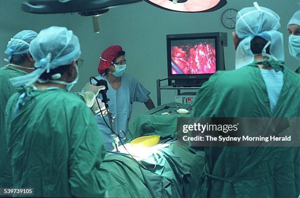 Doctors carrying out an extraperitoneal laparoscopic mesh repair of inguinal hernia at Holroyd Private Hospital, 10 April 1997. SMH Picture by STEVEN...