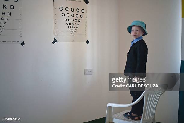 An albino boy has her eyes tested at a clinic run by the NGO, Standing Voice, on Ukerewe Island in Victoria lake during International Albinism...