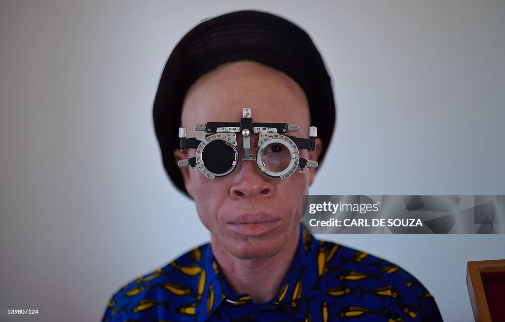 TANZANIA-ALBINOS-AFRICA-HUMAN-RIGHTS
