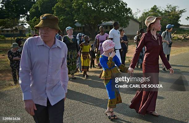 Albino people walk at a clinic run by the NGO, Standing Voice, on Ukerewe Island in Victoria lake during International Albinism Awareness day on June...