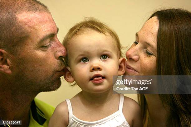 Hayley Walsh, 20-month-old, receives a kiss from Mum and Dad, Trevor and Lyn Walsh, after her Cochlear implant. Hayley was born profoundly deaf and...