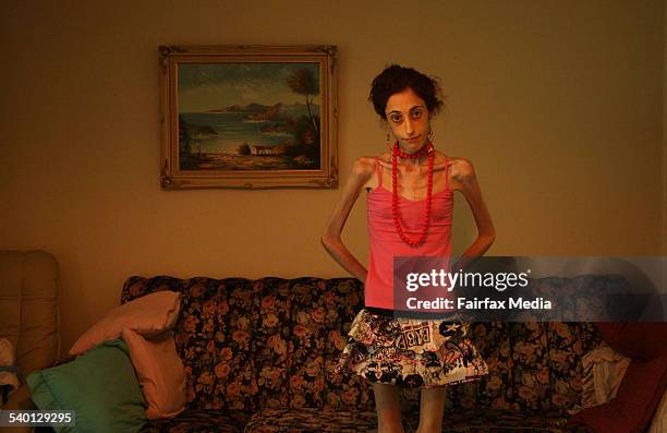 Catena Dimauro suffers from anorexia, and weighs a mere 26 kilograms, 5 January 2007. SHD Picture by JACKY GHOSSEIN