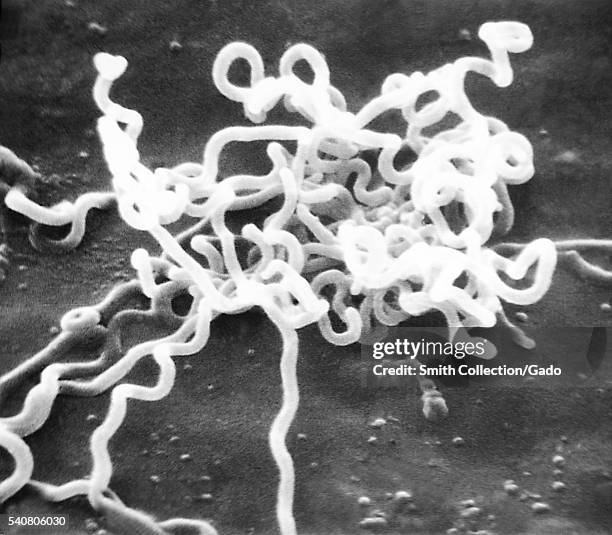 Syphlilus Rabbit 631 Syphilis Stock Photos, High-Res Pictures, and Images - Getty Images