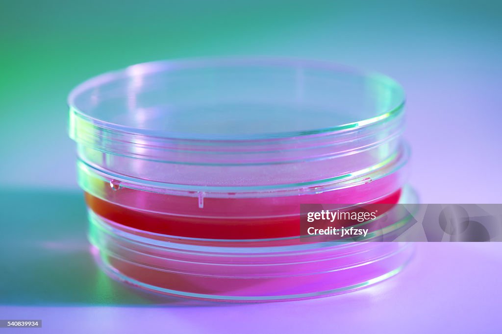 Red nutrition with agar in petri dish