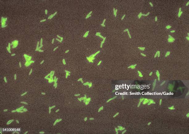 Legionella pneumophila cultured on supplemented Mueller Hinton medium, and stained using direct FA technique, 1977. The L. Pneumophila bacteria are...