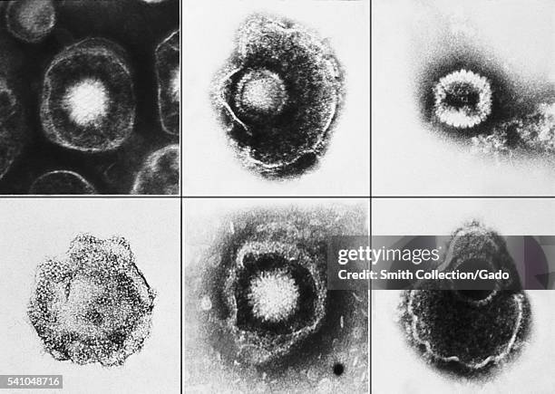 Microscope Photo Virus 522 Virus Electron Microscope Stock Photos, High-Res Pictures, and ...