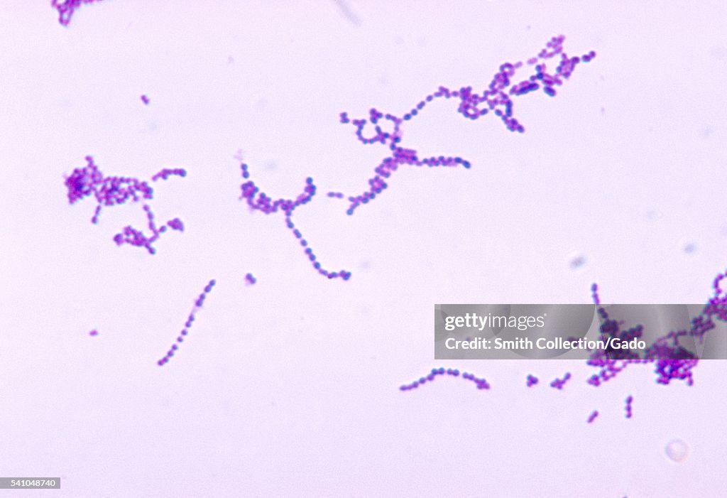 Streptococcus