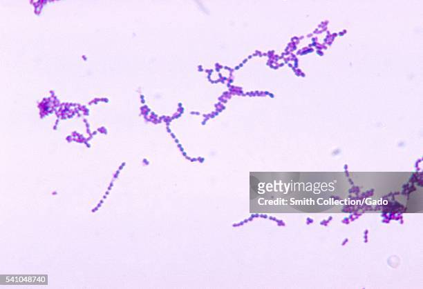 Photomicrograph of Streptococcus spp bacteria using Gram stain technique, 1970. Six groups are in this genus: A, B, C, D, F, and G, which and are...