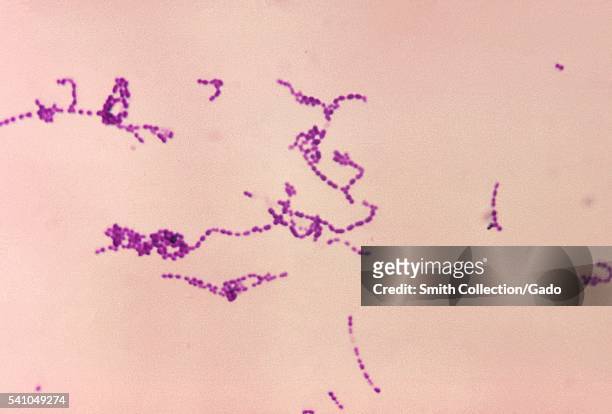 Photomicrograph of Streptococcus spp bacteria using Gram stain technique, 1970. Six groups are in this genus: A, B, C, D, F, and G, which and are...