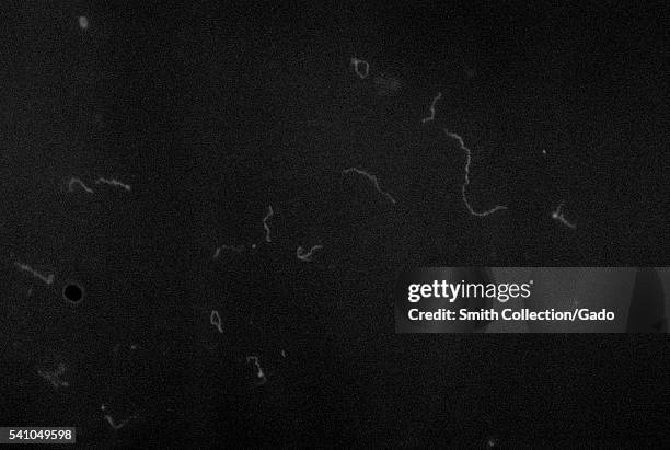 Treponema pallidum, IFA stain for Fluorescent Treponemal Antibody antigen, 1970. A blood test can detect the presence of antibodies produced by an...