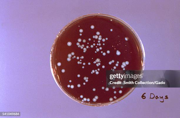 Charcoal-Yeast extract agar plate culture of Legionella pneumophila, 1978. Legionella pneumophila grows well on this medium, and the colonies take on...