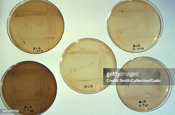 This image depicts five Petri dish culture plates that had been filled with an agar-based medium of yeast extract, cysteine, and ferric...