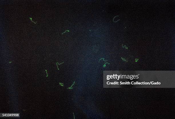 Treponema pallidum, IFA stain for Fluorescent Treponemal Antibody antigen, 1970. A blood test can detect the presence of antibodies produces by an...