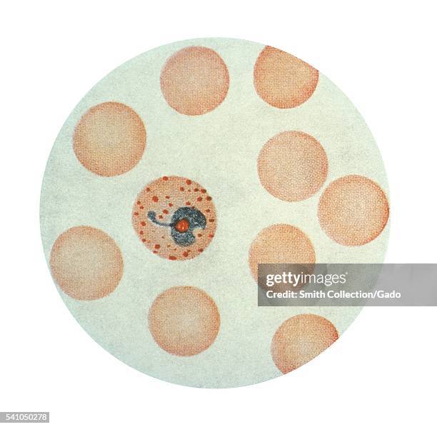 Photomicrograph of Plasmodium vivax in its erythrocytic trophozoite stage, using Wright's stain, 1979. X1500. This erythrocyte has become a mature...