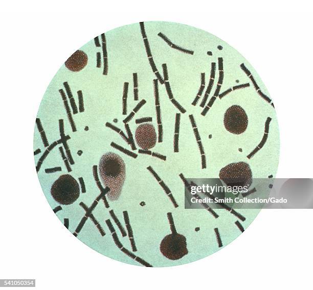 This illustration depicts a photomicrographic view of Bacillus anthracis bacteria taken from the peritoneum using and processed using a Hiss capsule...