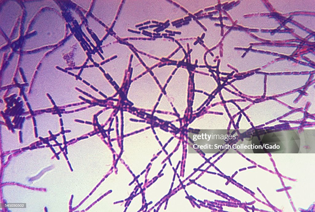 Bacillus Anthracis