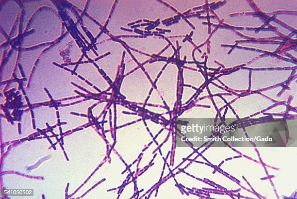 Photomicrograph of Bacillus anthracis bacteria using Gram-stain technique, 1975. Anthrax is diagnosed by isolating B. Anthracis from the blood, skin...