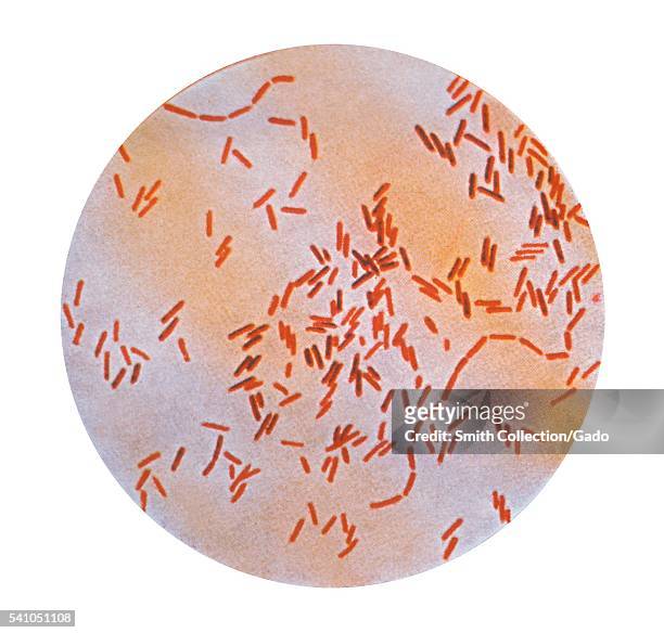This illustration depicts a photomicrograph of Salmonella typhi bacteria using a Gram-stain technique, 1979. Salmonella typhi, also known as...
