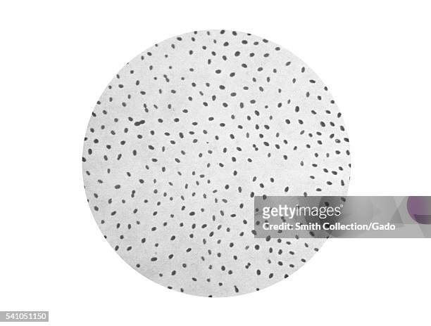 This is an illustration of a photomicrograph of the bacterium Brucella melitensis, initially named Micrococcus melitensis, 1979. This is a...