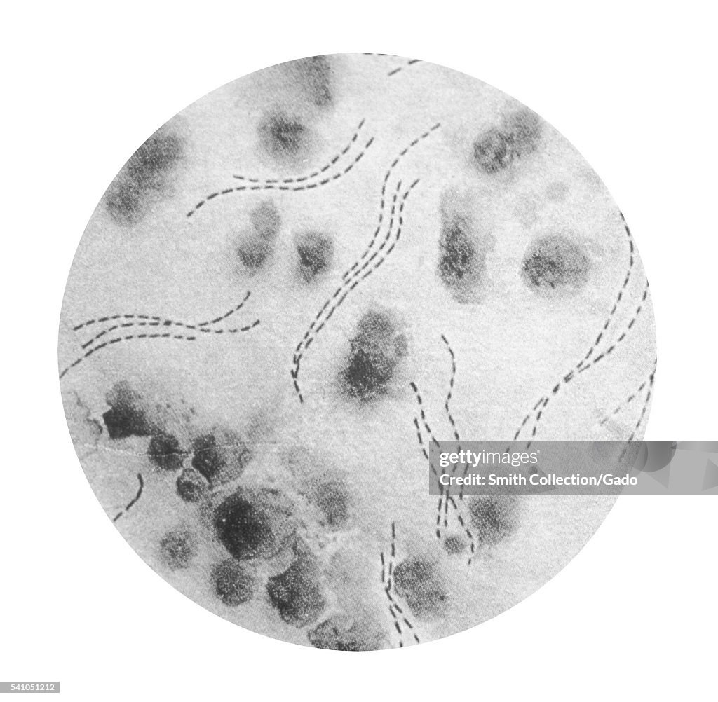 Haemophilus Ducreyi