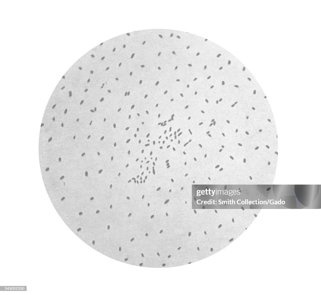 Bordetella Pertussis
