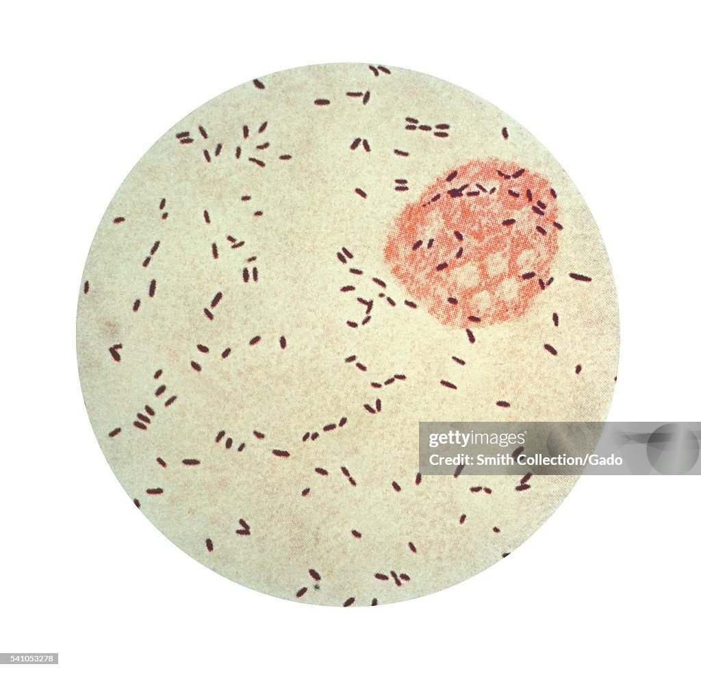 Propionibacterium (Corynebacterium) Acnes