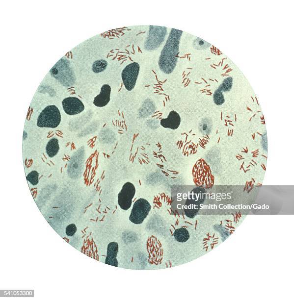 This illustration depicts a photomicrographic view of Mycobacterium leprae bacteria taken from a lepromatous skin lesion, 1979. M. Leprae is the...