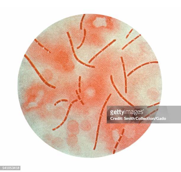 This illustration depicts a photomicrographic view of Bacillus anthracis bacteria taken from heart blood, and using carbol-fuchsin stain, 1979. B...